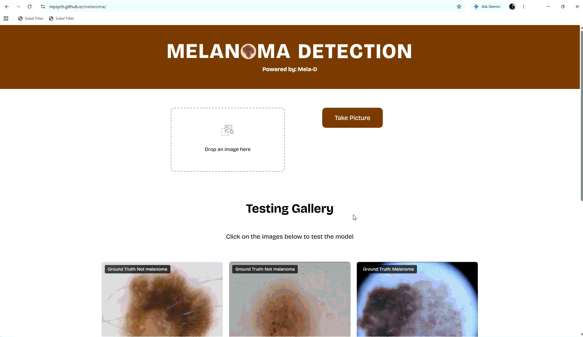 Web-based melanoma detection demo