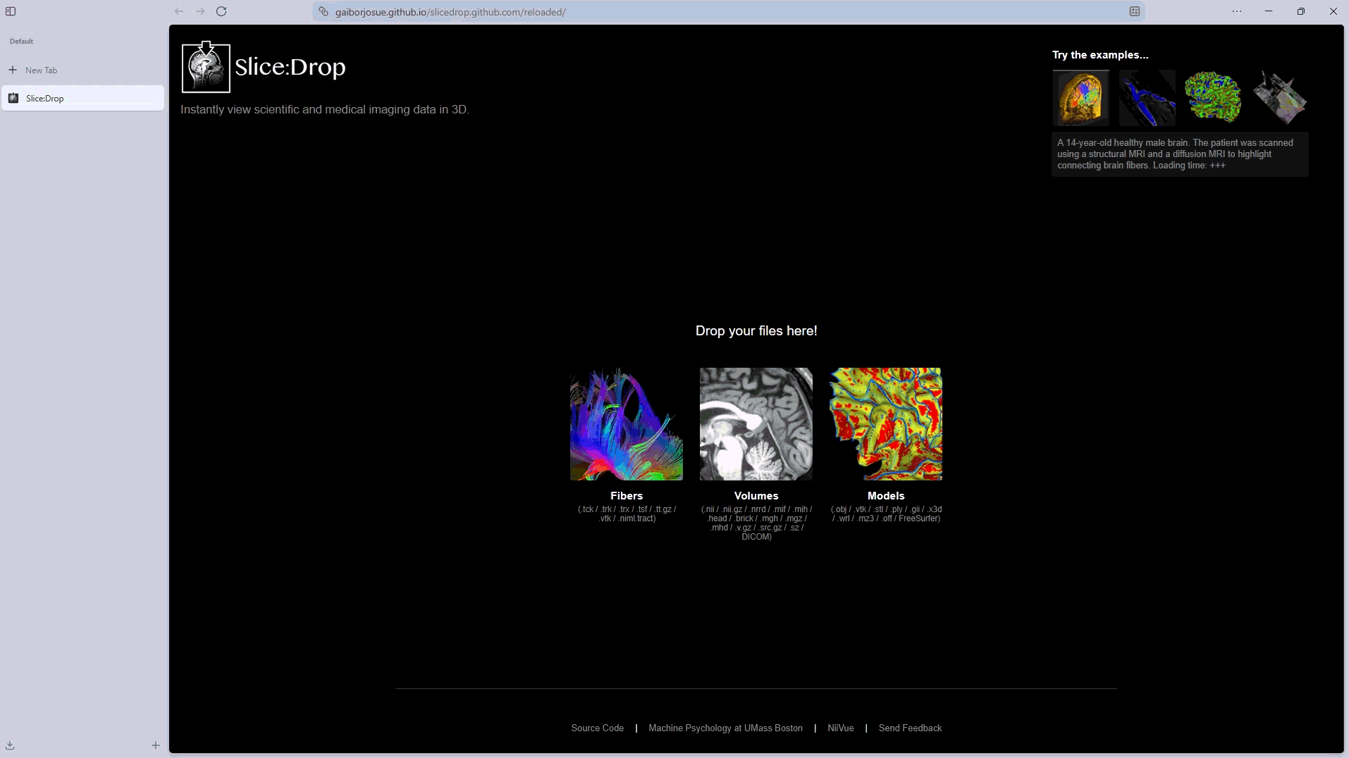 SliceDrop Reloaded medical image viewer preview